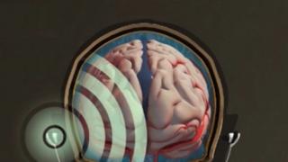 Слушалки тестват дали мозъкът ни се подува