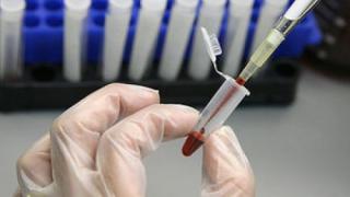 БАН откри уникален тест за наркотици