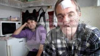 Човекът без лице се избави от тумора