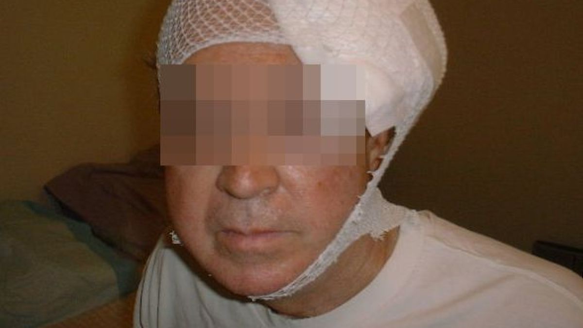 Пълен цирк! Натирена булка тръгна да си кърти дограмата, разцепиха главата на баща й