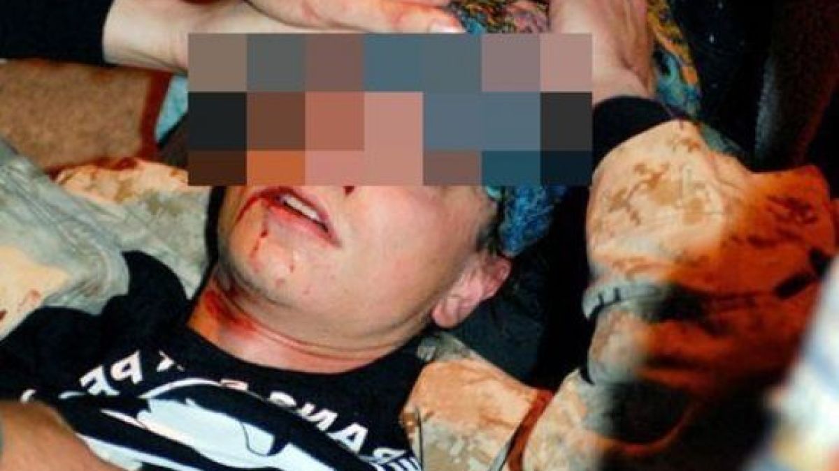 Семеен скандал: Тийнейджър нокаутира брат си с дядовата патерица