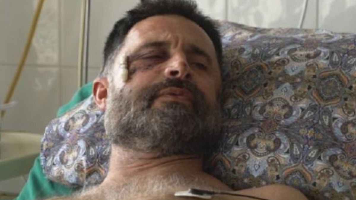 Пребитият фермер от Видинско: Раната от бездушието на полицията няма да зарасне