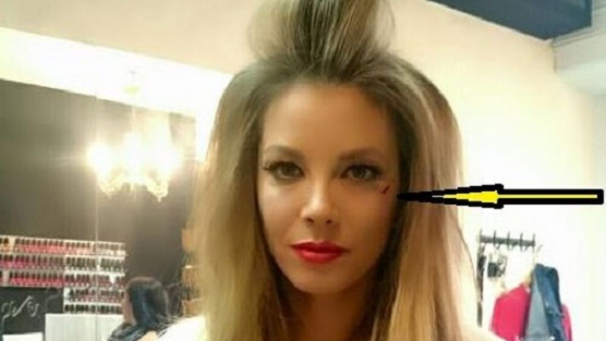 Емилия с кървава рана на лицето часове преди Наградите