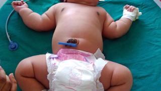 Роди се най-тежкото момиченце в света (СНИМКА)