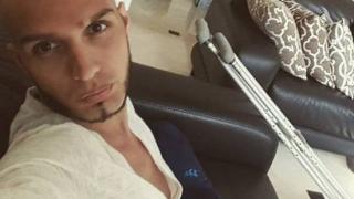 Джино Бианкалана с поредната операция! Изпадна в тежка депресия и заряза годеницата 