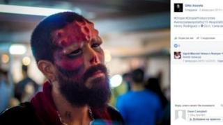 Фен на Red Skull си отряза носа, за да заприлича на него (БРУТАЛНИ СНИМКИ)