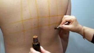 Видях как майка ми рисува квадрати на гърба на баща ми с йод срещу 20 болести. Пробвах и аз - ефектът е поразителен