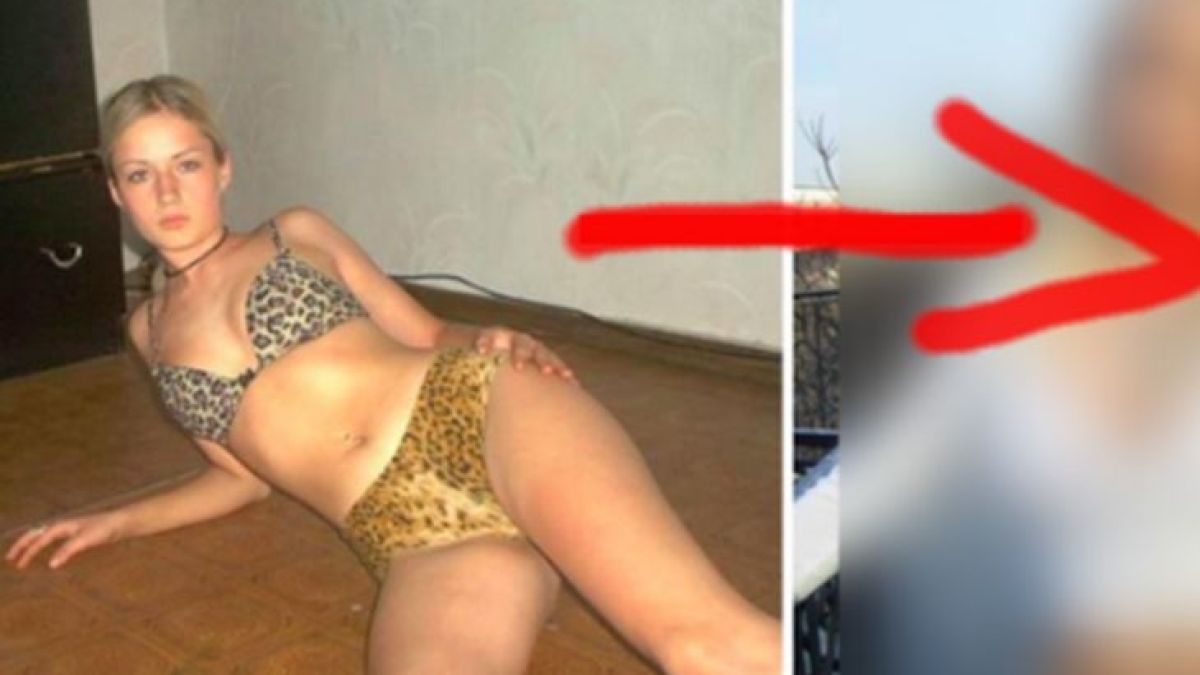 Тя премахна част от тялото си, за да сбъдне мечтата си. Вижте как изглежда днес, ще останете без думи (СНИМКИ 18+)