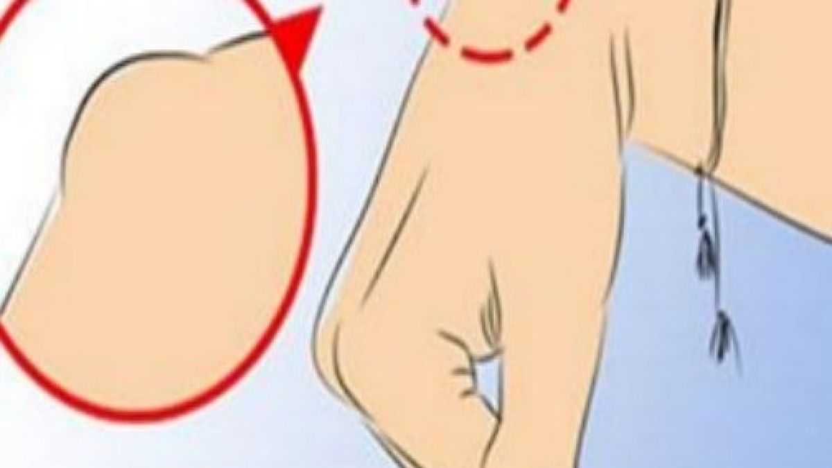 Ако забележите странни издутини на китката си ЗАДЪЛЖИТЕЛНО отидете на лекар защото...