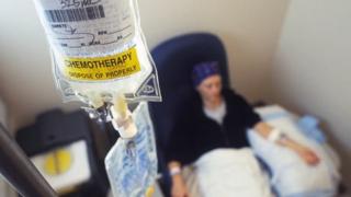 Няма регистър и реална статистика за онкоболните у нас! БАН твърди, че са над 400 хиляди