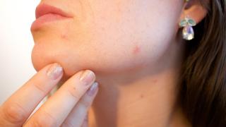 Тези храни съсипват лицето ви