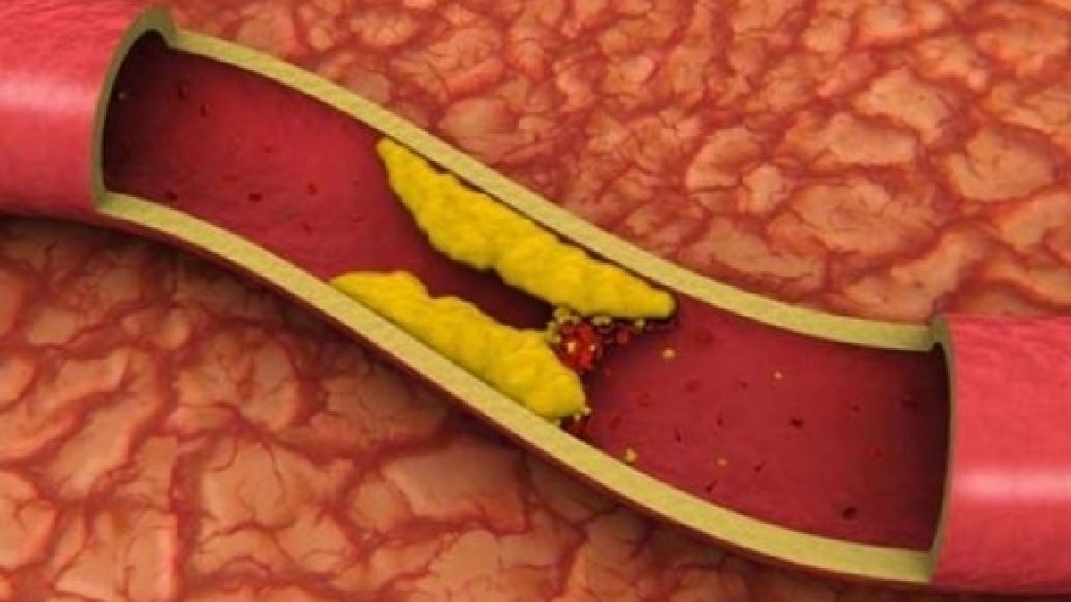 Прочистете запушените кръвоносни съдове с тези рецепти