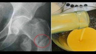 Само 1 лъжица, 3 пъти на ден от този ликьор и ще набавите нужното ви количество калций