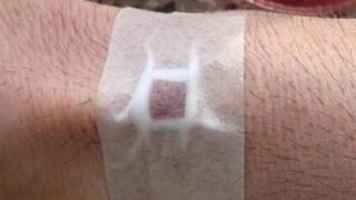 Премахнете бенките, брадавиците и пъпките с тези уникални рецепти! 