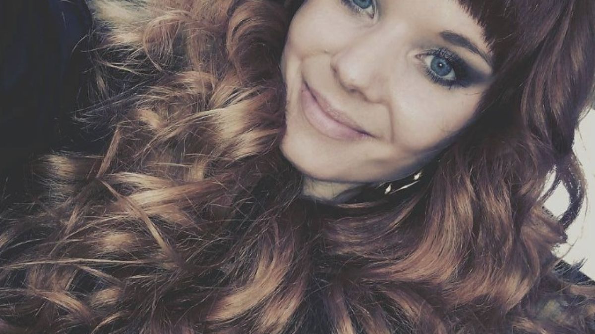 Тази ослепителна красавица страда от много рядка болест, която постепенно унищожава тялото й (СНИМКИ 18+)