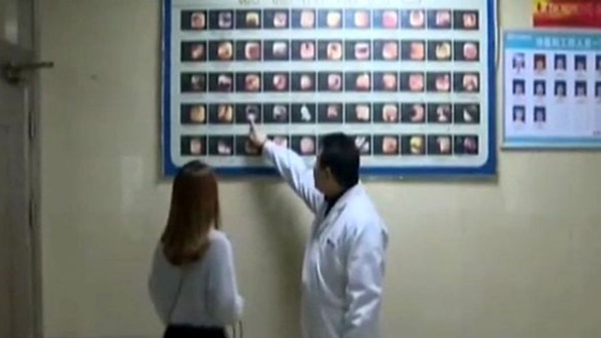 Китайка отиде на преглед заради болки в стомаха, лекарите останаха в шок от видяното (СНИМКИ)