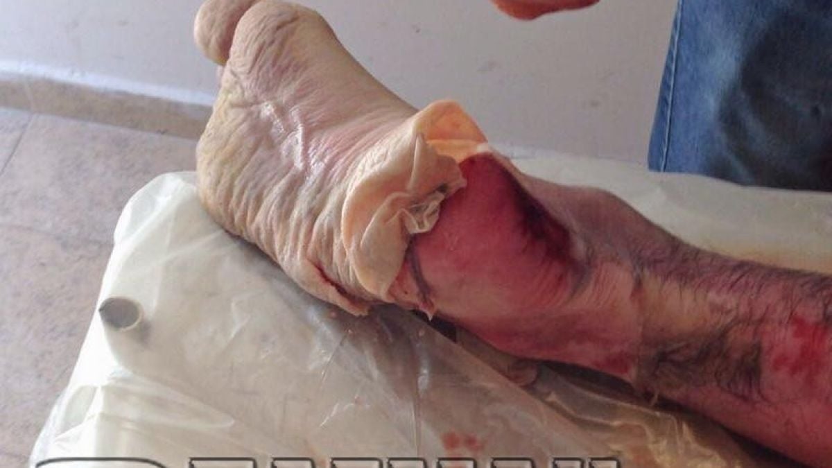БРУТАЛНИ СНИМКИ (21+) на трупа на страшилището Горан Горанов, починал мистериозно в бургаския затвор (НЕ Е ЗА ХОРА СЪС СЛАБИ СЪРЦА)