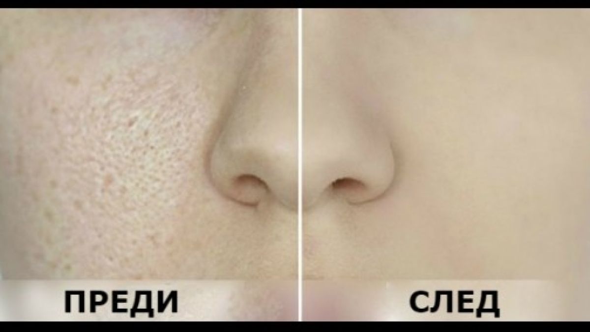 Тази маска ще направи лицето ви гладко като бебешко дупе  