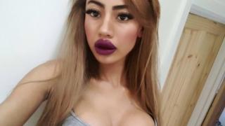 Тя искаше да прилича на тв водеща и се подложи на пластични операции, но накрая...