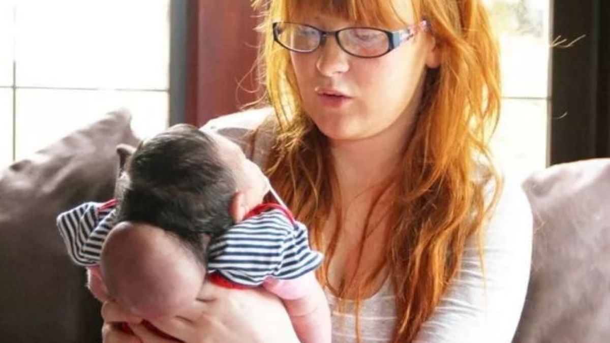 Брутална реалност: Мей Роуз се роди с мозък извън черепа - обречена е на смърт, но ето какво свърши майка й (СНИМКИ)