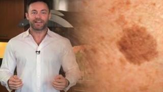 Известен дерматолог разкри: Премахването на кафявите петна по лицето и кожата е възможно с този прост трик!