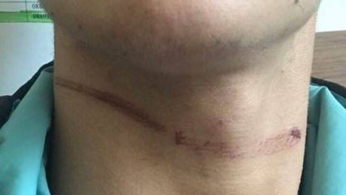 Майката на момчето, пребито от бургаски батки, направи шокиращи разкрития! (СНИМКИ 18+)
