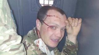 Нещо невиждано от времето на Майдана се случва в Киев: Полицията бие и се гаври с бандеровци и неонацисти (ВИДЕО)