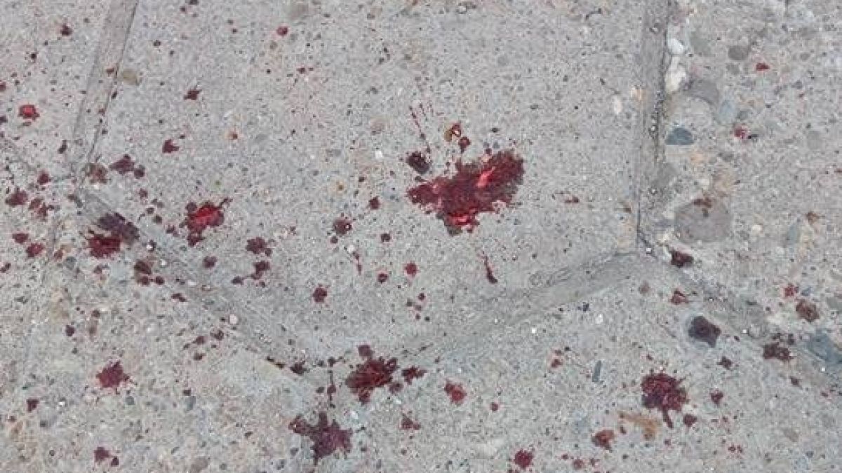 Първо в БЛИЦ! Маги Халваджиян изригна и показа потресаващи СНИМКИ (18+)