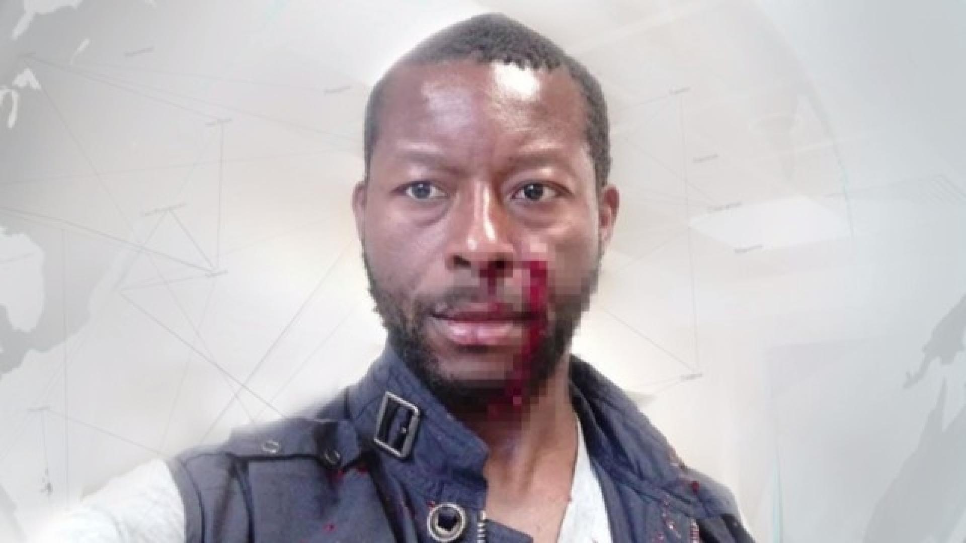 Пребиха финансист от Лондон в центъра на София (СНИМКА 18+)