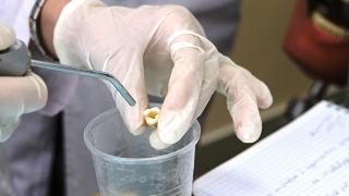 Стоматоложка извади 22 здрави зъба на пациентка, за да ѝ сложи чене и прибра тлъста сума