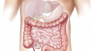 Признаци и симптоми, които издават наличието на колоректален рак