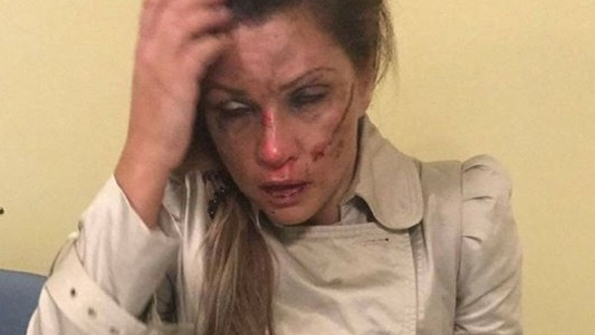 Български манталитет! Мъже се перчат в нета за пребитата зверски от приятеля си - швед Александра: Заслужава си го! (СНИМКИ 18+)