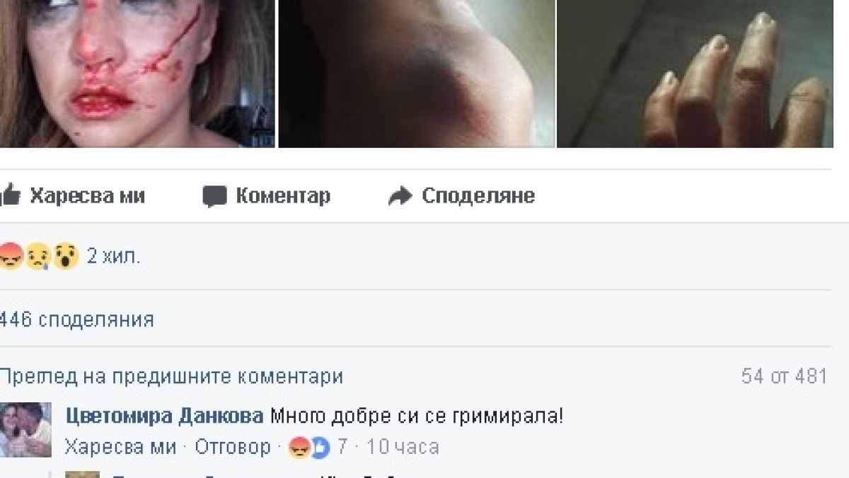 Първо в БЛИЦ! Пребитата като куче от швед Сани Алекса – излъгала? Рут Колева побесня и... (СНИМКИ 18+)