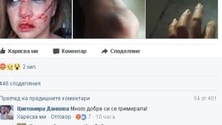 Първо в БЛИЦ! Пребитата като куче от швед Сани Алекса – излъгала? Рут Колева побесня и... (СНИМКИ 18+)