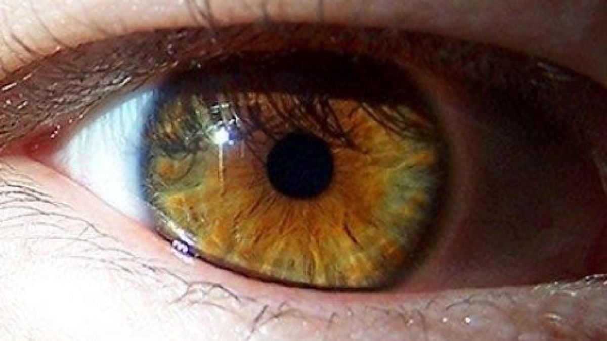Ако имате пъстри очи, трябва да знаете важните неща, които ви отличават от другите хора 