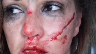 Битата като куче от швед Сани Алекса с нова порция разкрития за насилника си (ВИДЕО)