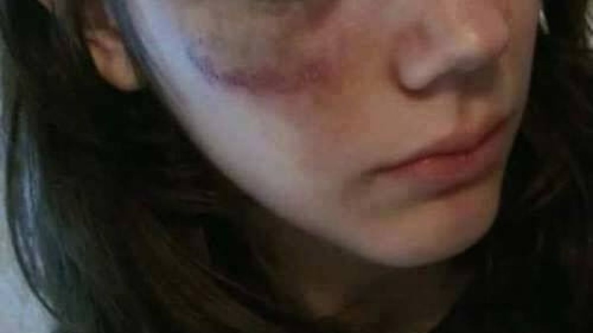 Пребита от мъжа си жена засне синините по лицето си и написа разтърсваща изповед: Днес получих цветя... 