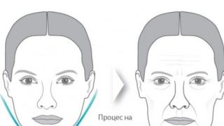 Годинките си казват думата и бръчките се появяват? Е, сега има лесно спасение