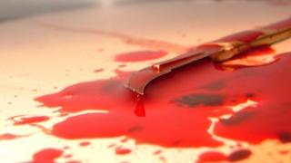 Касапи нападнаха мъж със сабя край Плевен, резнаха му...