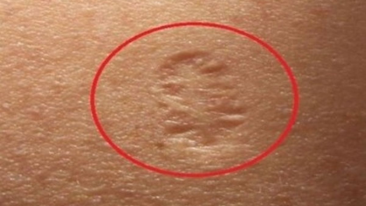 Цялата истина за малкия белег на горната част на лявата ръка, който някои хора имат!