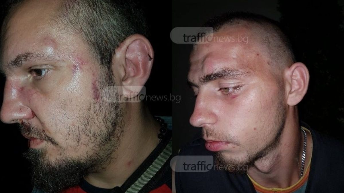Ново безчинство: Тумба роми начело с Кальо Тарзана нападнаха с ножове и бутилки хората в заведение в село Дунавци (СНИМКИ)