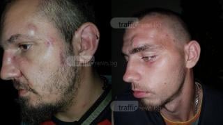 Ново безчинство: Тумба роми начело с Кальо Тарзана нападнаха с ножове и бутилки хората в заведение в село Дунавци (СНИМКИ)
