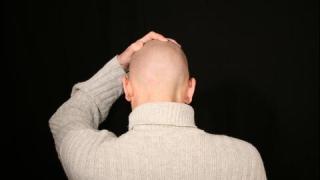 Оплешивявате? Няма страшно! Откриха нов ефективен лек за този проблем