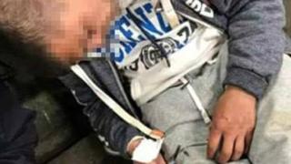 Ужасяващ кадър! Момчета са се предрусали в метростанция, иглите още стърчат от тях (СНИМКА)
