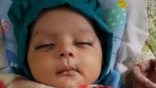 Зъболекари извадиха 7 зъба на новородено! (ШОКИРАЩА СНИМКА)