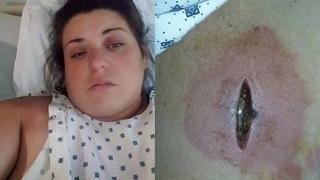 Млада жена: През нощта ме ухапа нещо като комар, а на сутринта бях на крачка от смъртта (СНИМКИ)