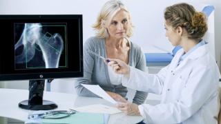 Русенка си направи изследвания на костната плътност и попита специалист: Какво е най-доброто лечение на остеопороза?