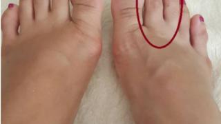 Погледнете пръста си: Ако забележите това, краката ви търсят помощ
