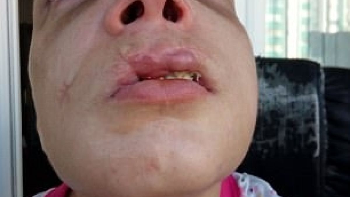 Ужасяващи СНИМКИ (18+): Българска секс робиня показва какво са направили с нея трафиканти на хора 