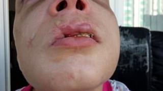 Ужасяващи СНИМКИ (18+): Българска секс робиня показва какво са направили с нея трафиканти на хора 